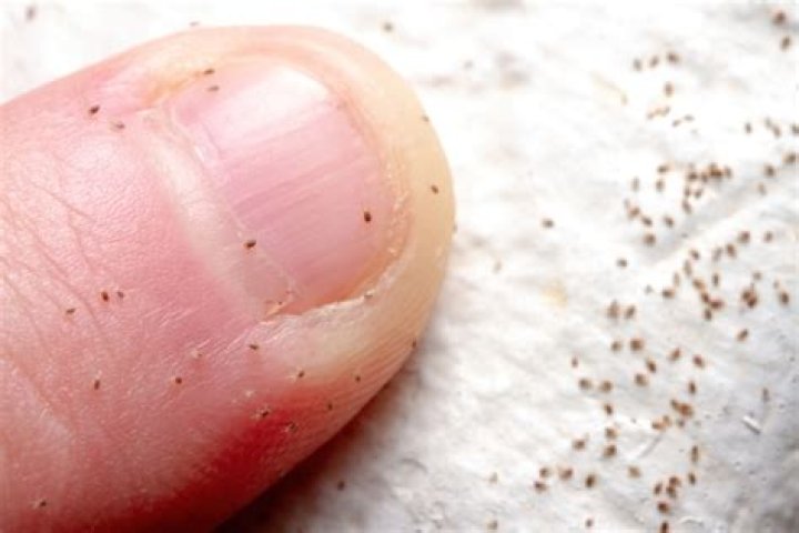 Are mites visible?