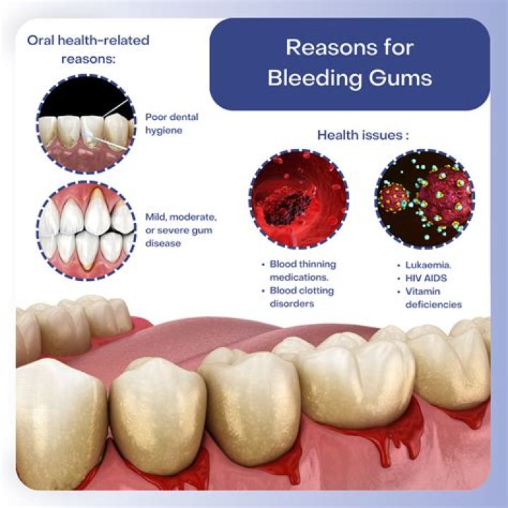Can bleeding gums heal on its own?