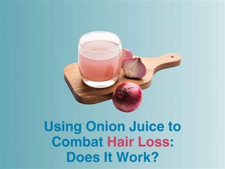 Can I directly apply onion juice on hair?