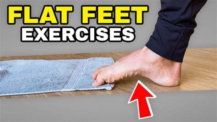 Can I strengthen my arches?