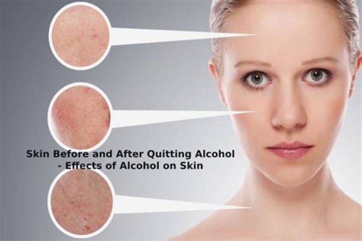 Can isopropyl alcohol be absorbed through the skin?