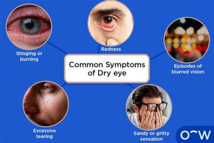Can MS cause dry eyes?