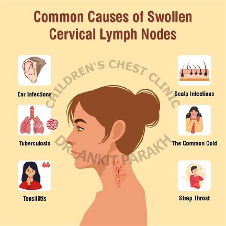 Can sinus problems cause swollen lymph nodes?