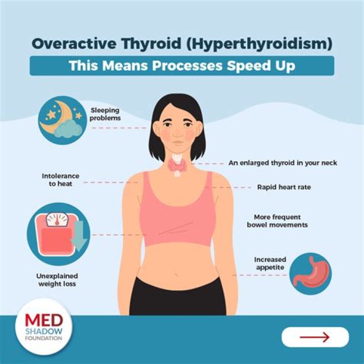 Can you develop hypothyroidism after surgery?