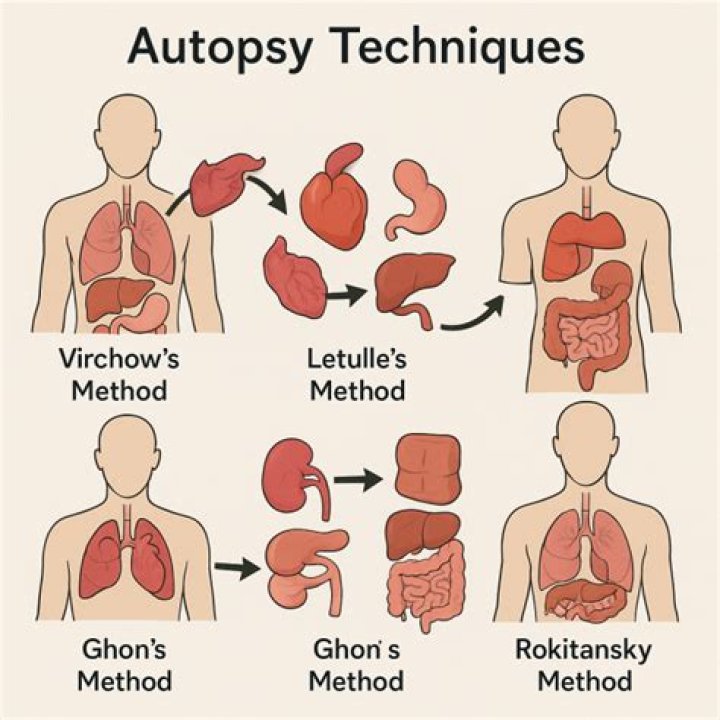 Can you do an autopsy after cremation?