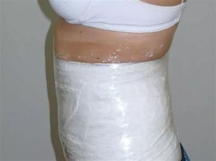 Can you lose weight by wrapping your stomach in plastic wrap?