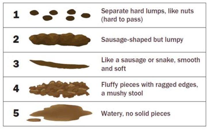Can you poop while your sleeping?