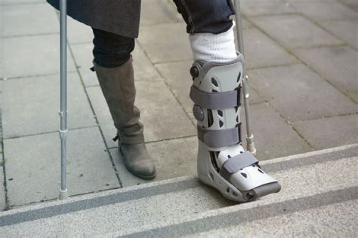 Can you walk on a fractured foot?