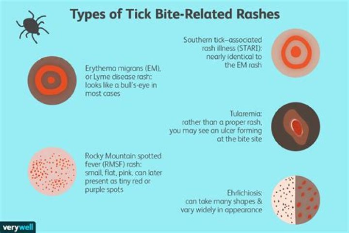 Do all tick bites leave a mark?