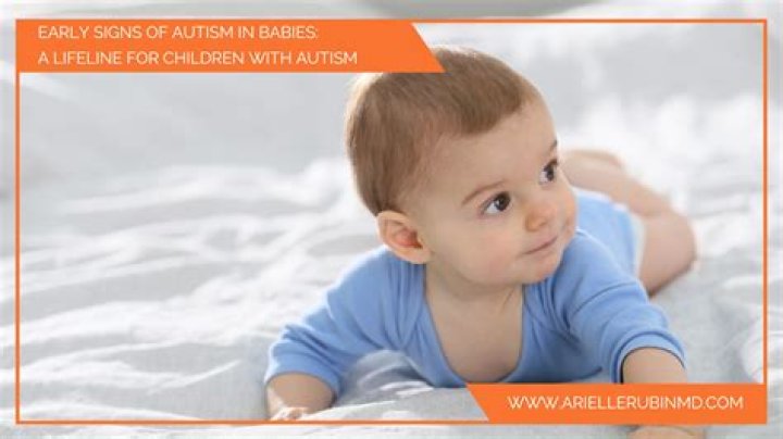 Do autism babies watch TV?