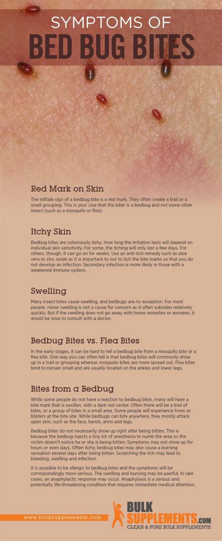 Do bedbugs bite?