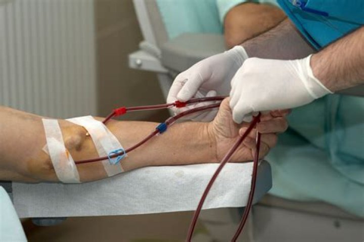Do dialysis patients pee?
