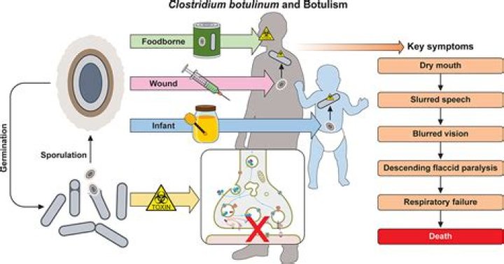 Does botulism cause diarrhea?