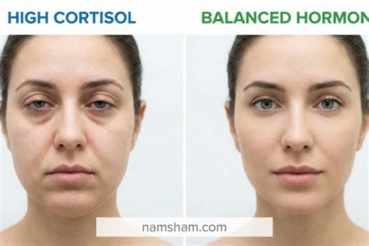 Does cortisol affect eyes?