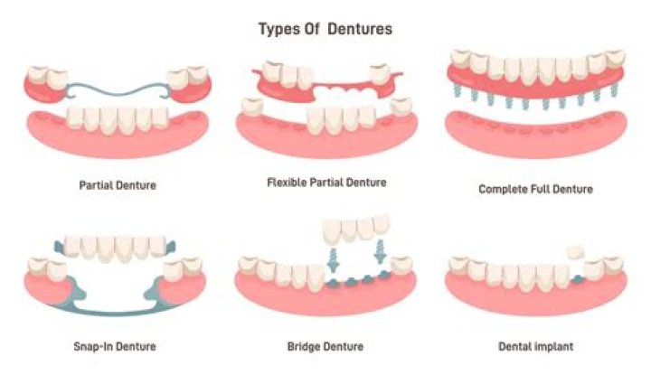 Does it hurt to get a partial denture?