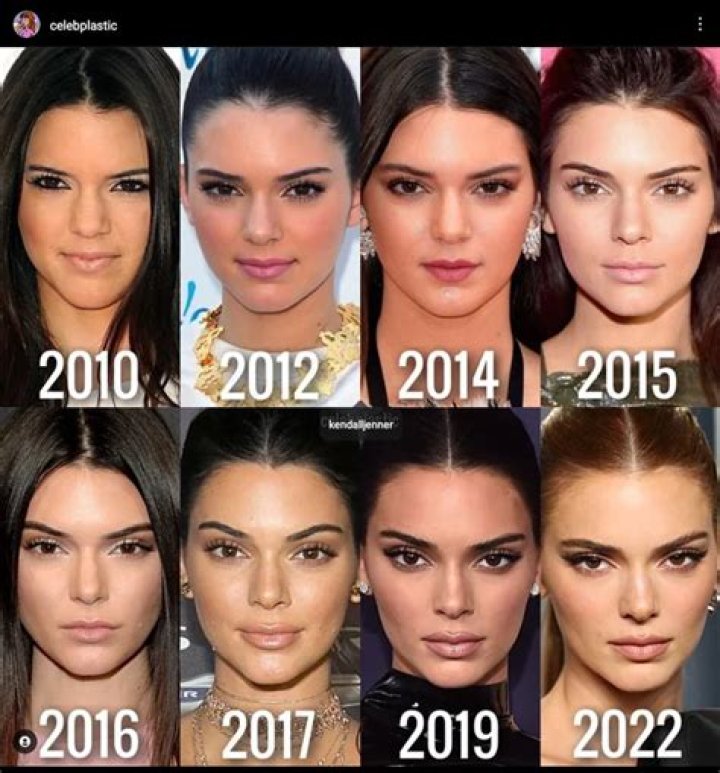Does Kendall Jenner have abs?