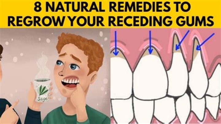 How can I regrow my receding gums naturally?