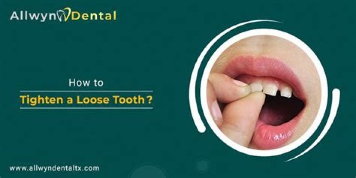 How can I tighten my teeth?