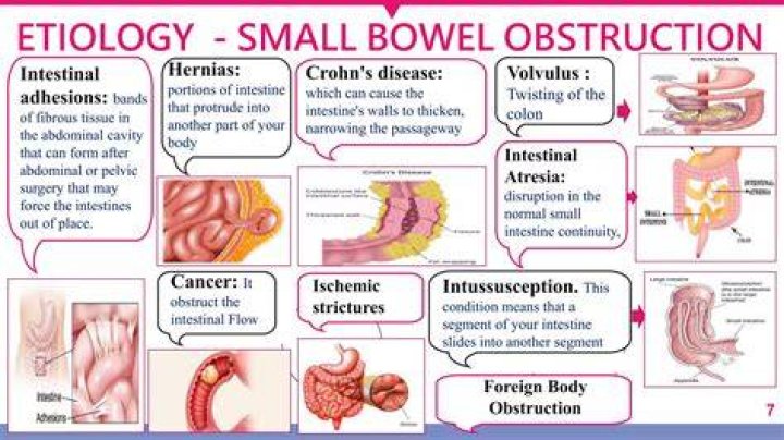 How do they remove a bowel obstruction?