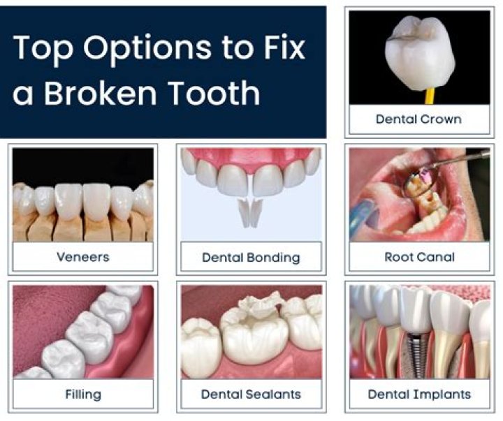 How do you fix rotting teeth?