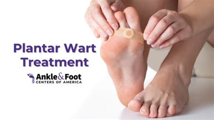 How do you get rid of HPV warts on your feet?