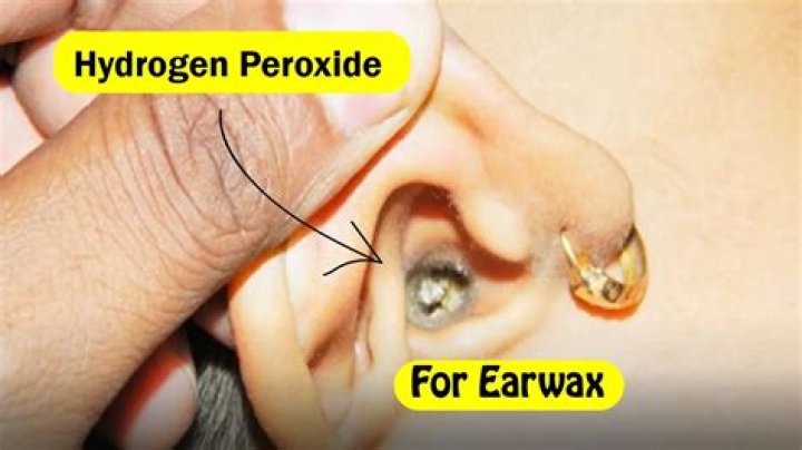 How does hydrogen peroxide remove ear wax?