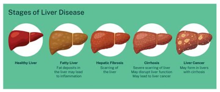 How does lemon water affect the liver?