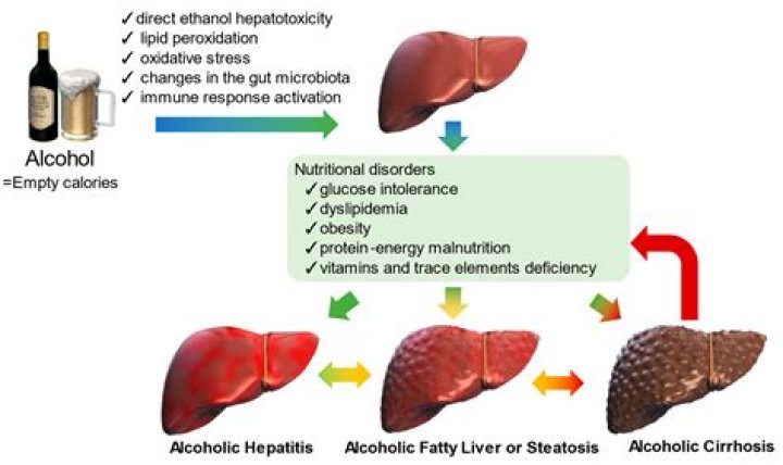 How much would you have to drink to damage your liver?