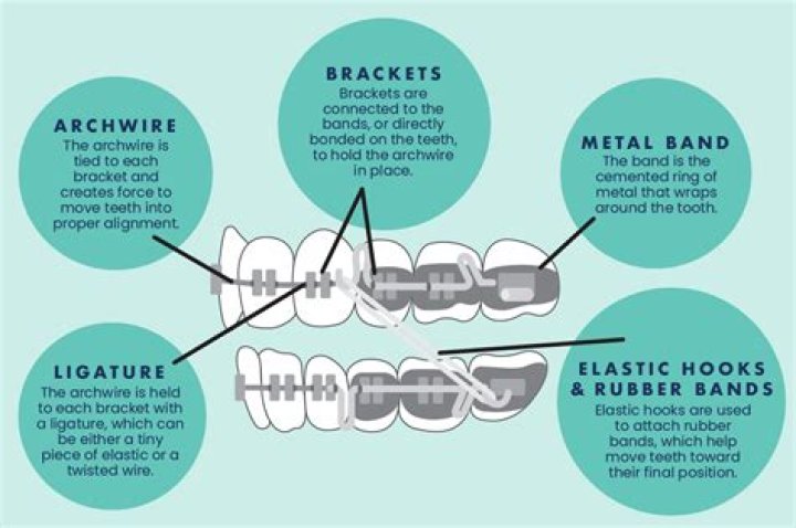 Is it normal for my back teeth to not touch with braces?