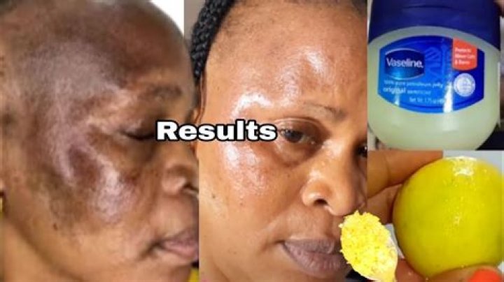 Is it OK to put lemon on face?