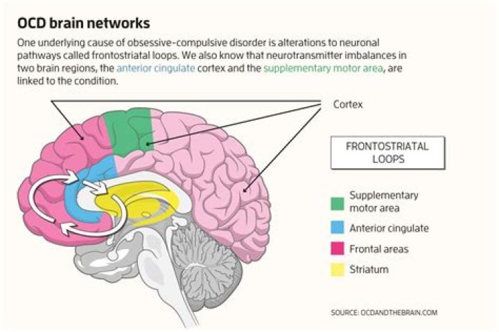 Is OCD a brain disorder?