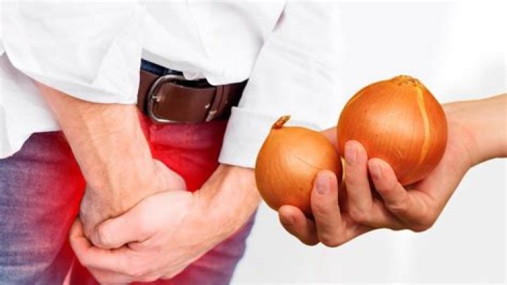 Is onions good for prostate?