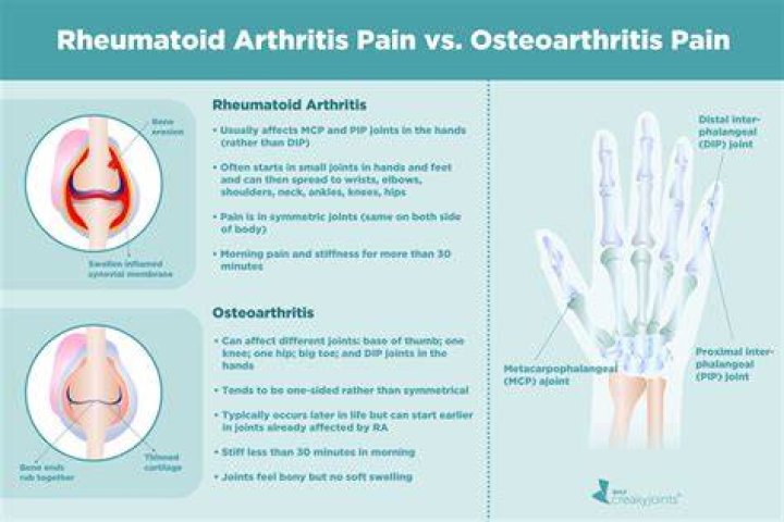 Is there a difference between rheumatoid arthritis and inflammatory arthritis?