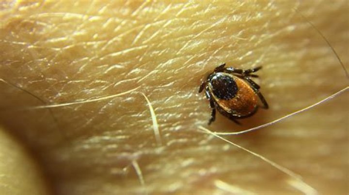 Should a tick bite hurt after removal?