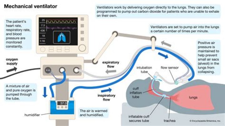 What are the chances of coming off ventilator with COVID?