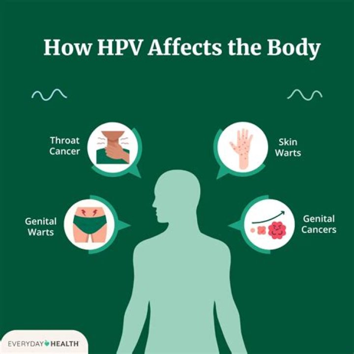 What are the signs of an HPV flare up?