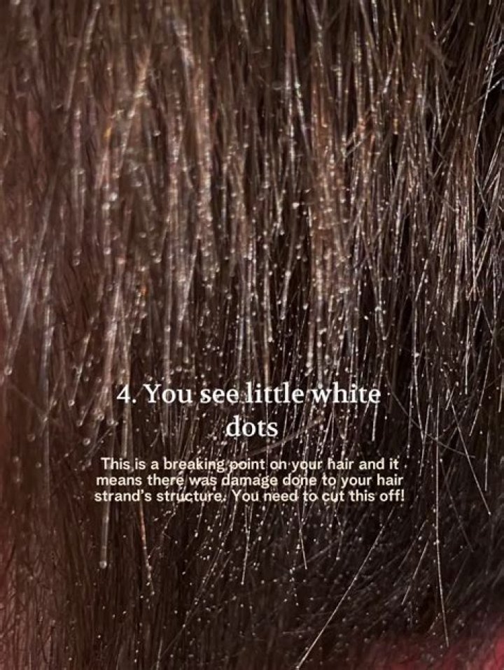 What are these white rocks in my hair?