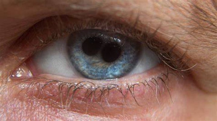 What do you call a person with one eye?
