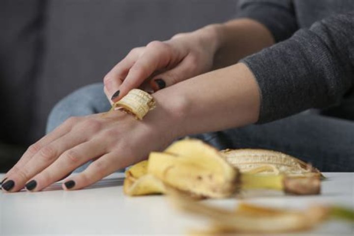 What does rubbing a banana peel on your feet do?