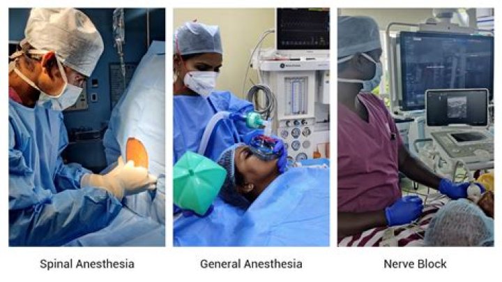 What kind of anesthesia is used for endoscopy?