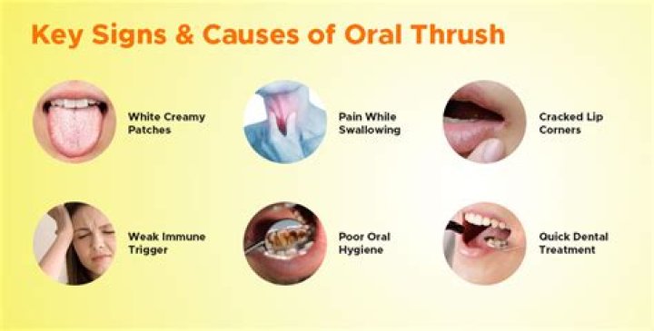 What should I eat with oral thrush?