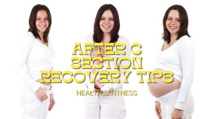 When should I start walking after C-section?
