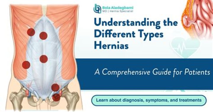 Where are women's hernias located?