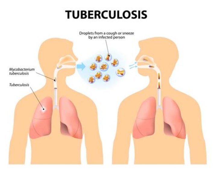 Where did tuberculosis come from?