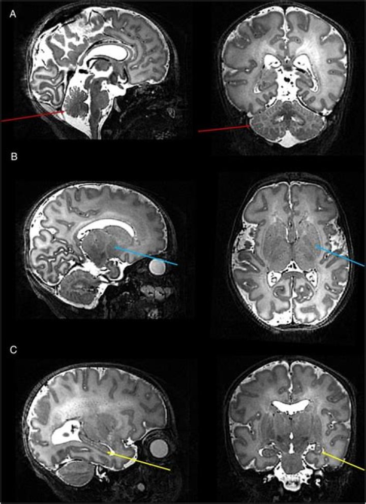 Who has a 7 tesla MRI?