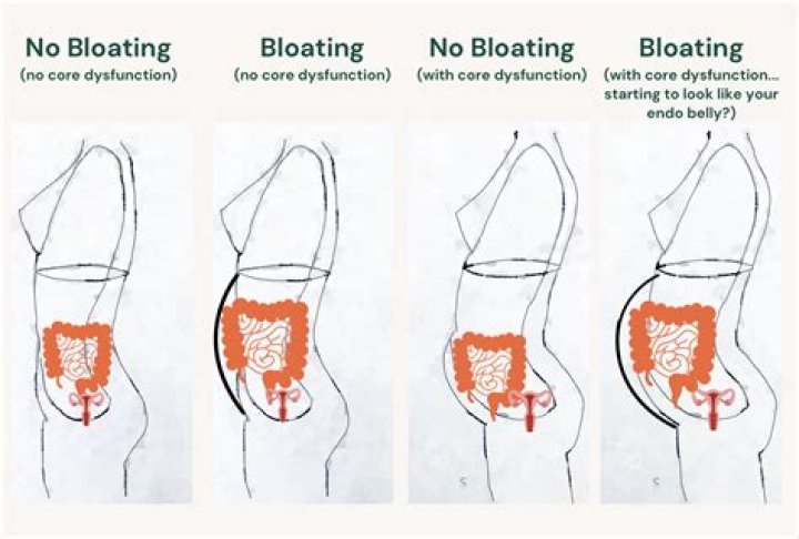 Why can I push my stomach out and look pregnant?