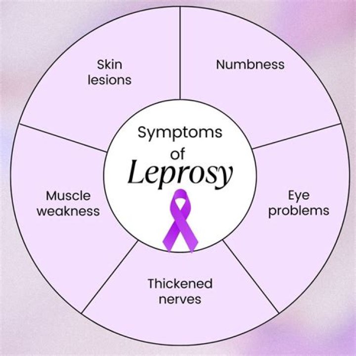 Why did leprosy decline in Europe?