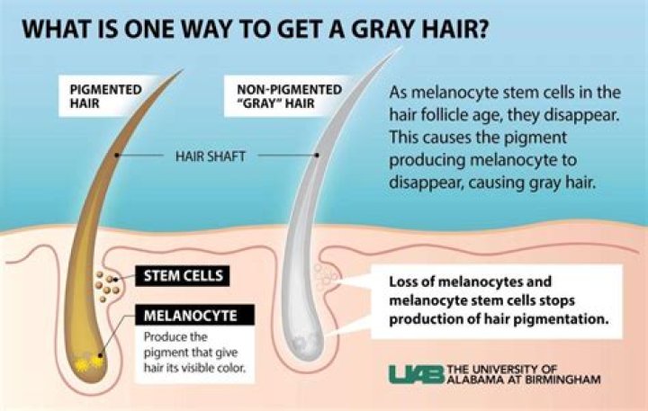 Why do I have grey hair at 14?