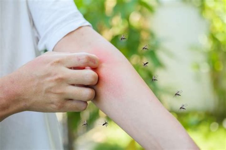 Why does scratching mosquito bite feel so good?