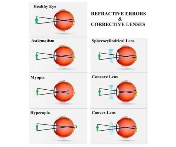 Why has my eyesight suddenly got worse?